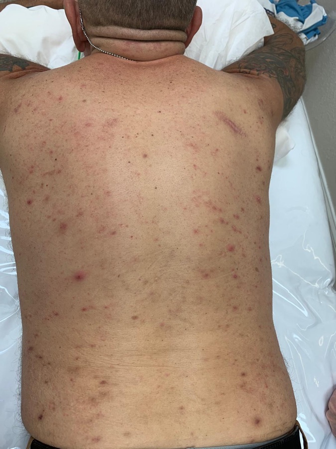 After back wax at Natura