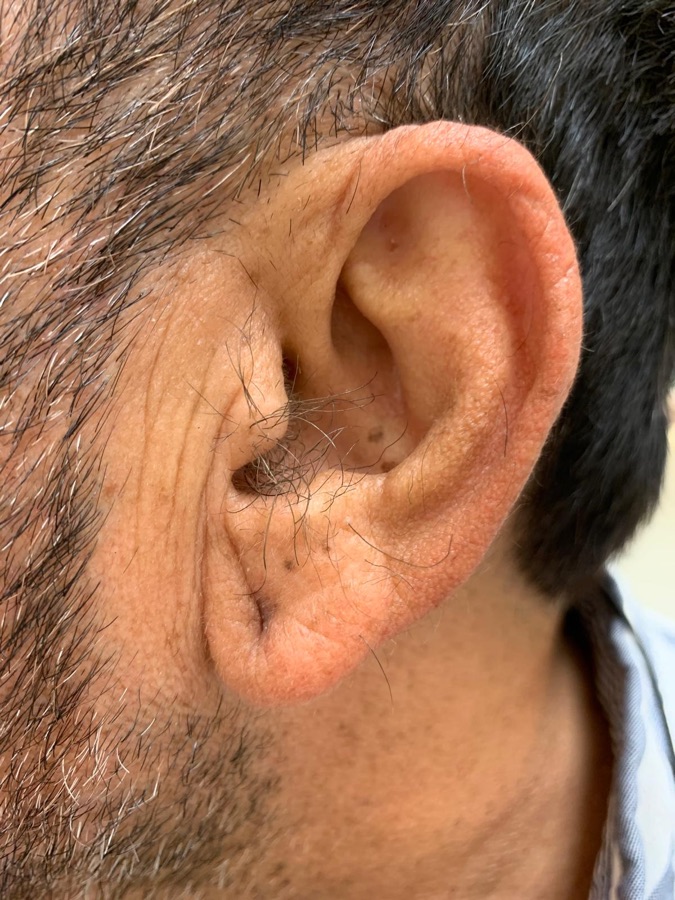 Before ear & nose wax at Natura