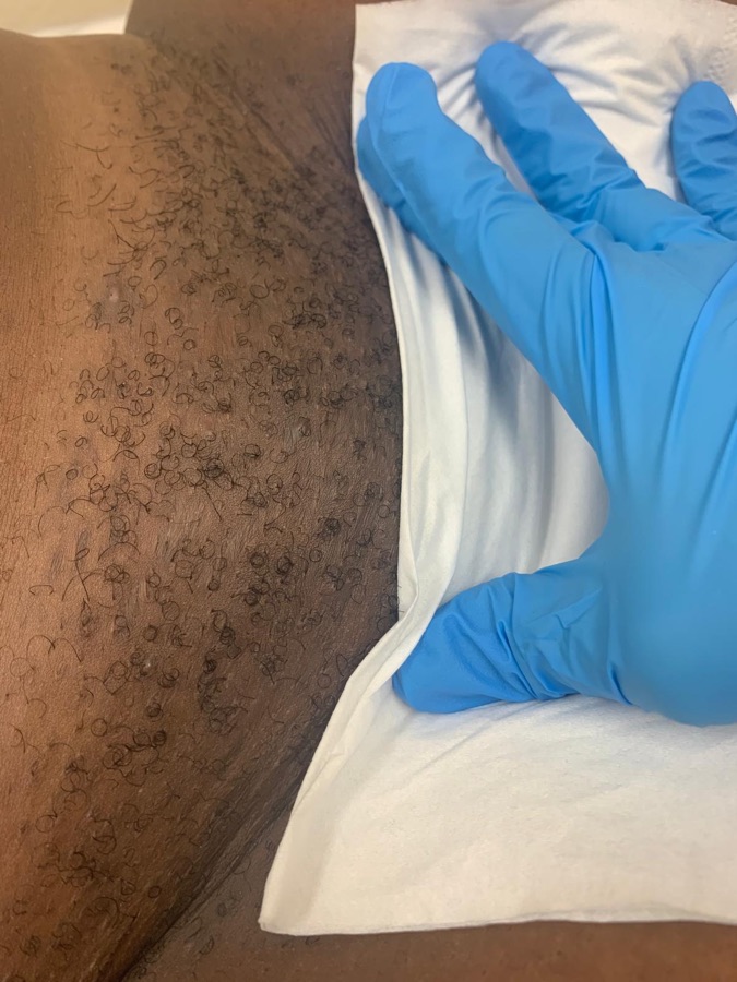 Before bikini wax at Natura