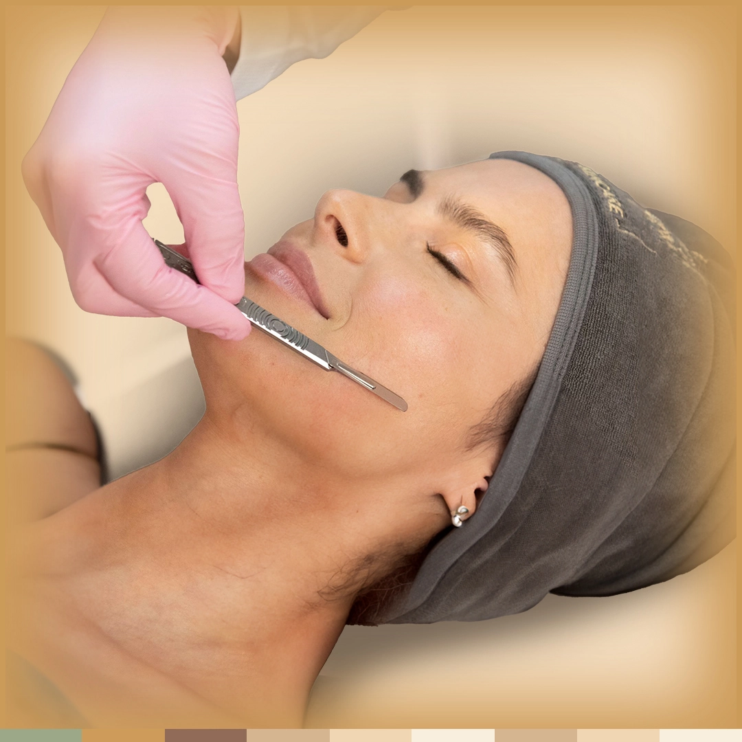 DERMAPLANING