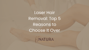Laser Hair Removal: Top 5 Reasons to Choose It Over Electrolysis