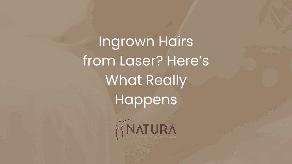 Ingrown Hairs from Laser? Here’s What Really Happens