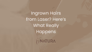Ingrown Hairs from Laser? Here’s What Really Happens