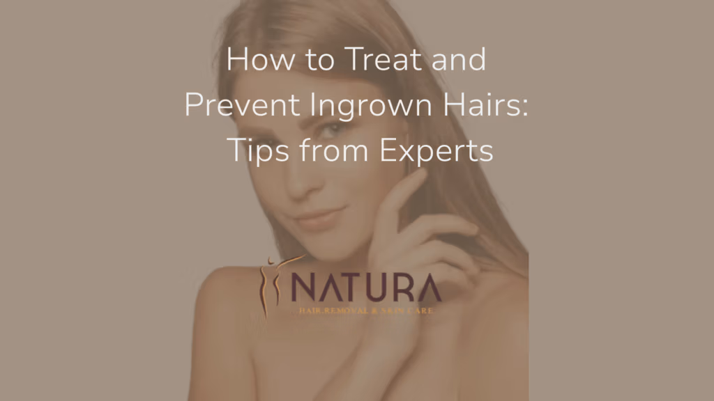 How to Treat and Prevent Ingrown Hairs: Tips from Experts