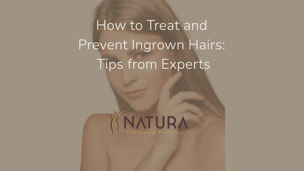 How to Treat and Prevent Ingrown Hairs: Tips from Experts