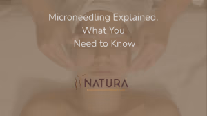 Microneedling Explained: What You Need to Know