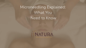 Microneedling Explained: What You Need to Know