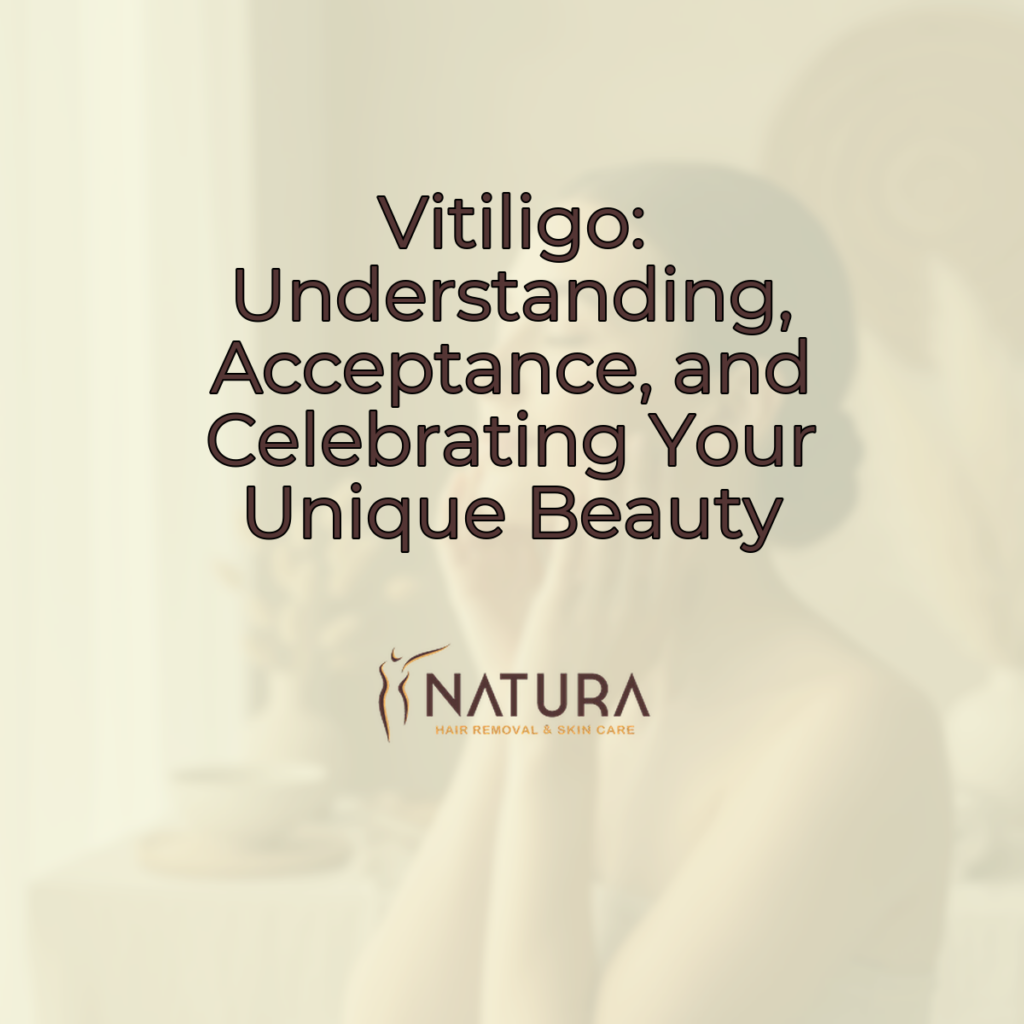 A serene female model with vitiligo, in a half-profile pose, softly touching her face, radiating confidence against a blurred warm background.